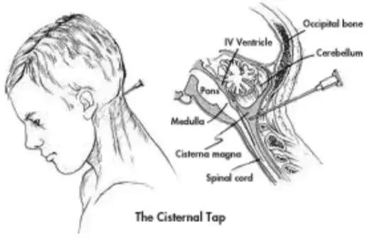 一个卑劣的人体实验，至今无人承担责任