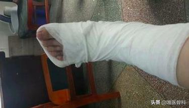 不小心摔伤骨折了怎么办,户外骨折怎么办