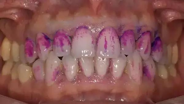 月子牙刷真的好用吗,月子牙刷好用么