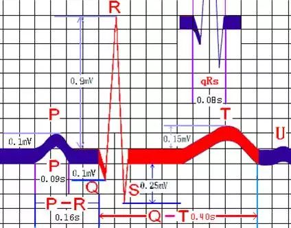 心律失常55分钟讲解,心律失常心电图讲解视频教程全集
