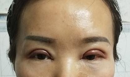 男的割双眼皮好看吗,割双眼皮好看吗动画