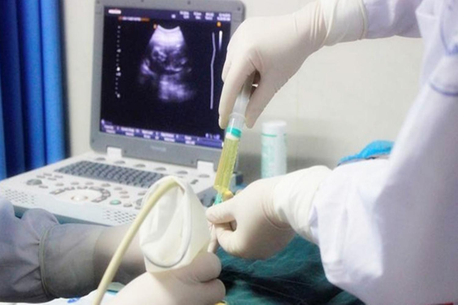 在孕期，什么情况下需要做羊水穿刺？了解后没必要过分担心