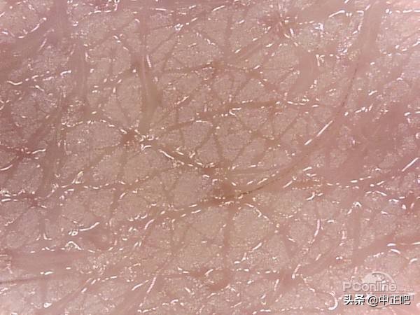 秋冬季节皮肤干燥发痒怎么办,秋冬皮肤干裂涂什么