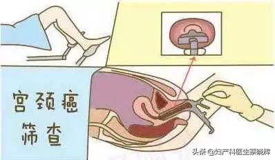 打完hpv疫苗有必要做抗体检查吗,打hpv疫苗必须要做宫颈癌筛查吗