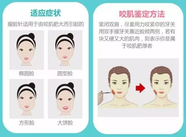 皮肤医学美容中心,打瘦脸针对皮肤有影响吗