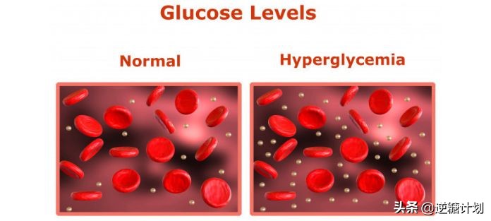 动脉粥样硬化心脏病吃什么保健品,脑动脉硬化血糖高冠心病