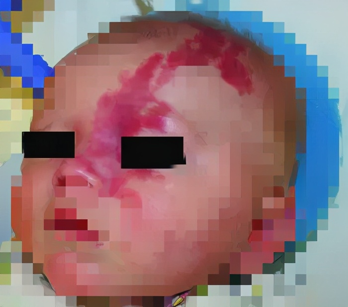 深圳市人民医院黄智勇,人民医院黄智勇