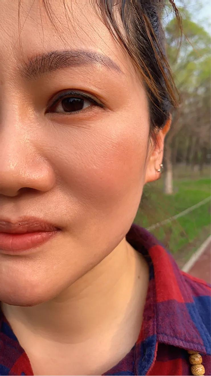 皮肤衰老了，长了印第安纹怎么办？