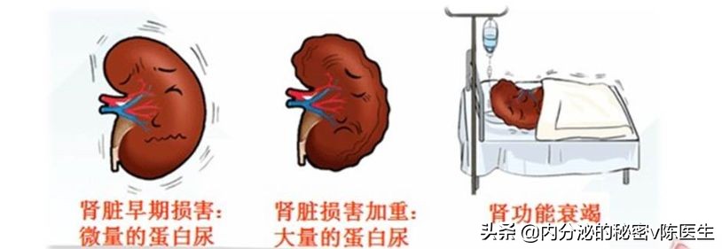 中医对糖尿病的辨证论治,糖尿病脾肾阳虚便秘调理顺序