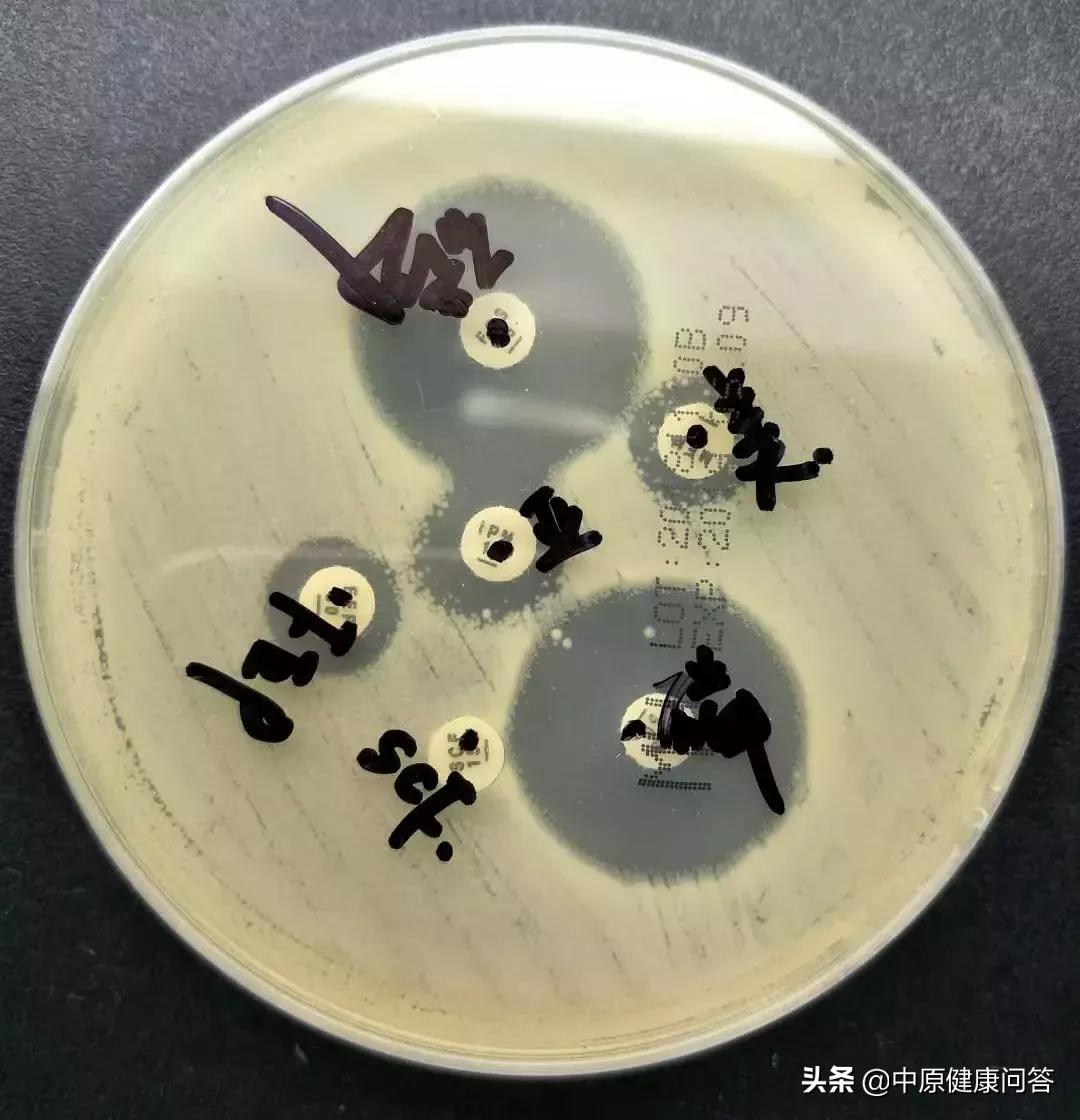 孩子一出生就进重症监护室,刚出生的婴儿在重症监护室9天