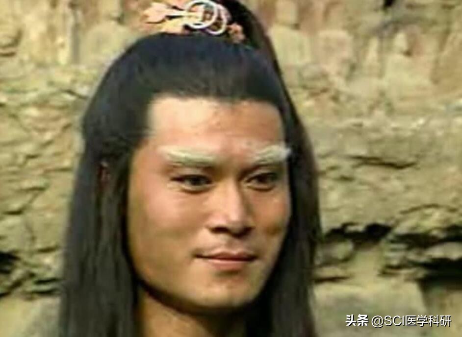 女子割双眼皮变白眉大侠,一女子割双眼皮变白