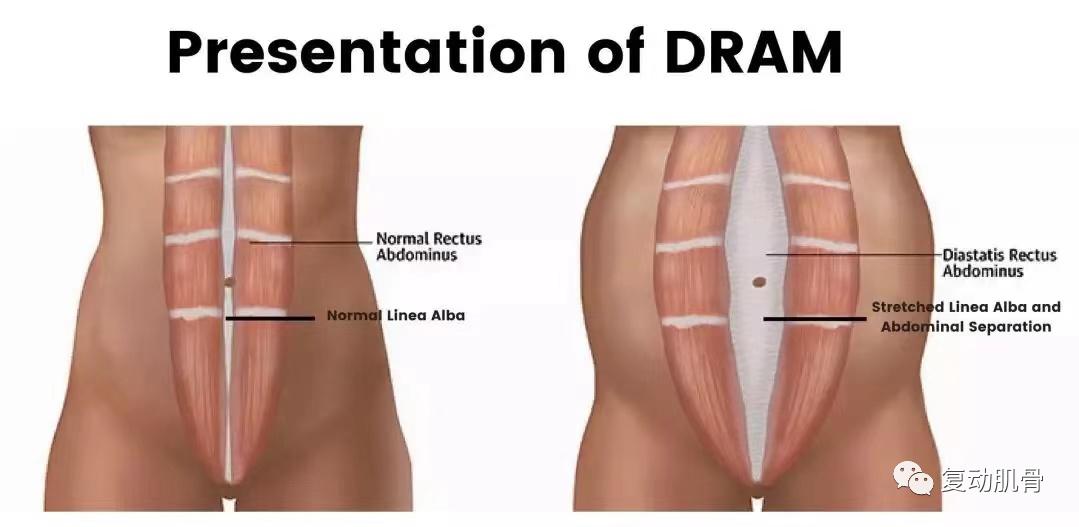 产后疼痛，这里总有一个方法适合你