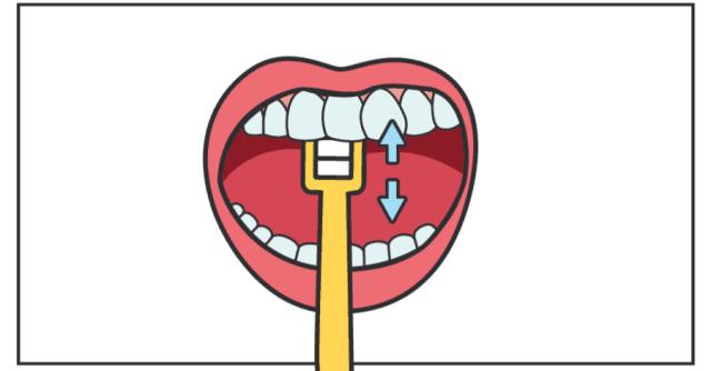 孩子龋齿怎么干预和治疗,小孩子治疗龋齿最好的药