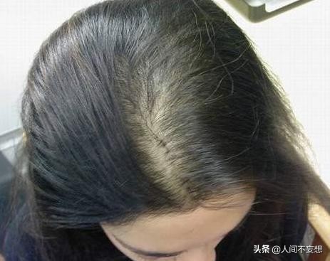 头发又细又软又塌脱发,头发细软塌发量少怎么办