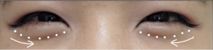 让眼睛变大变有神的最简单方法,怎么让眼睛变亮变有神变大