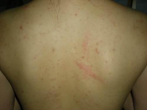 去角质的10个小常识,如何判断要不要去角质呢