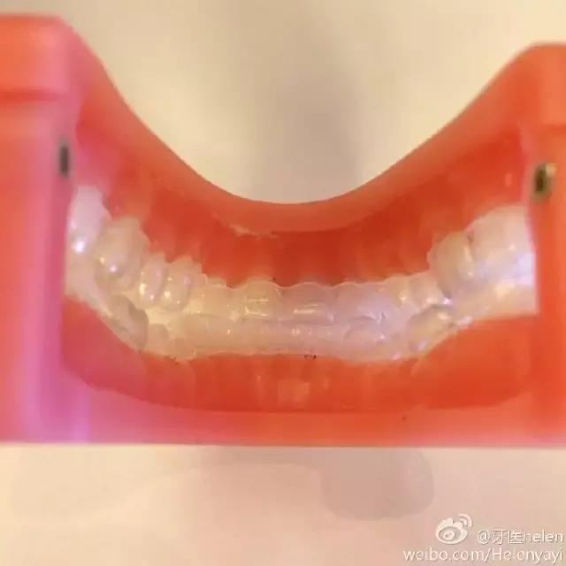 helen榻跨,Helen榻跨涓績