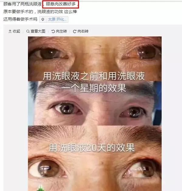 洗眼液使用规范,洗眼注意事项