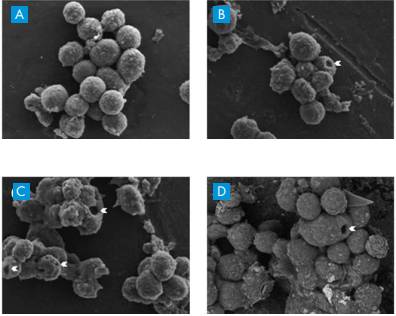 古巴癌症疫苗效果怎么样,古巴研究出癌细胞疫苗