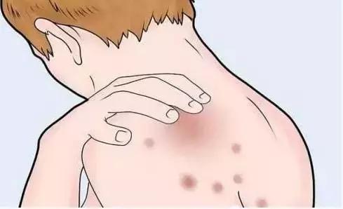 这种病虽不起眼，却能让人痒到怀疑人生，冬季高发！