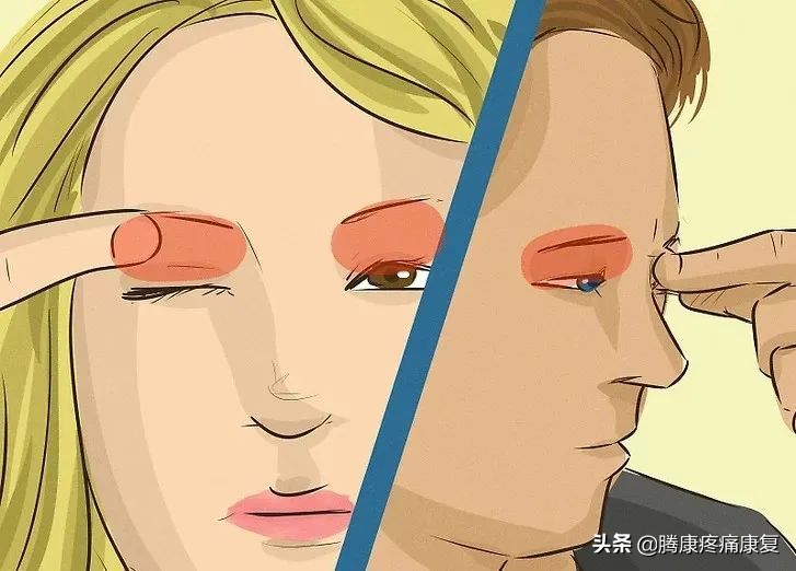 如何缓解紧张焦虑头痛,肌紧张性头痛的症状