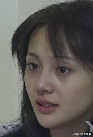 黑眼圈的自救指南有哪些,黑眼圈自救指南看这里