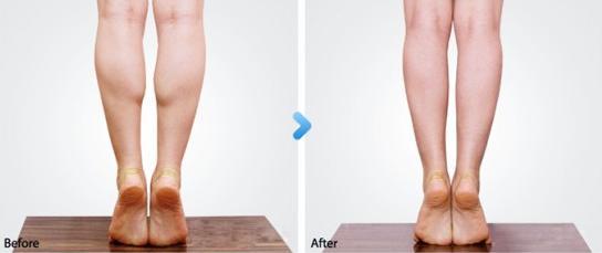 小腿粗怎么办?拉伸准没错~经典瘦小腿拉伸动作,每天拉伸瘦小腿