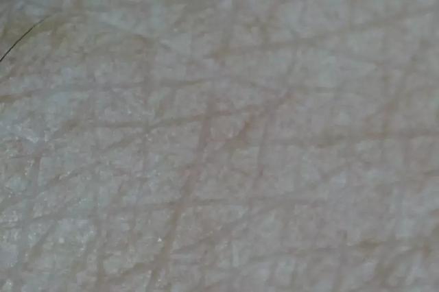 硬刚女皇龙妈也扛不住法令纹，2条沟壑让人心疼，贴一贴就消了