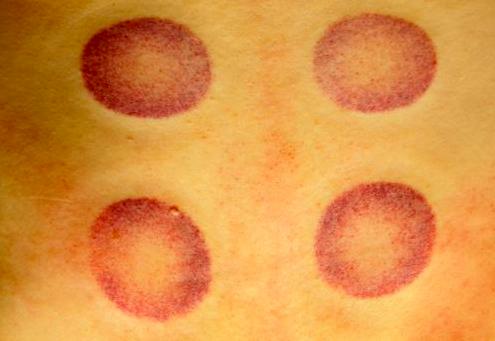 欧洲瘟疫死亡2500万人是哪一年,人类最大的瘟疫