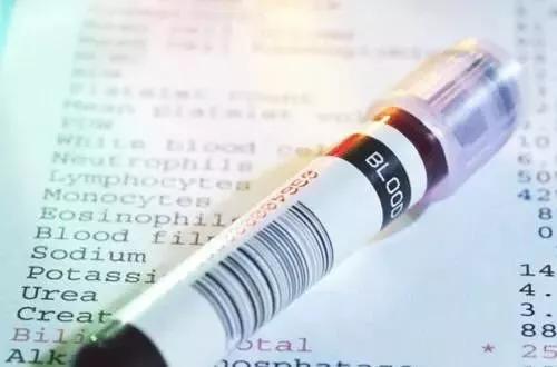 女性检查误区多体检当天别化妆,女性体检避坑