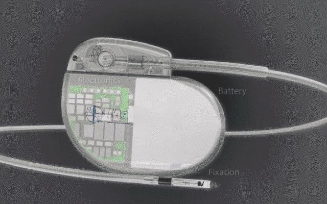 起搏器安装后要注意什么,加装心脏起搏器注意事项