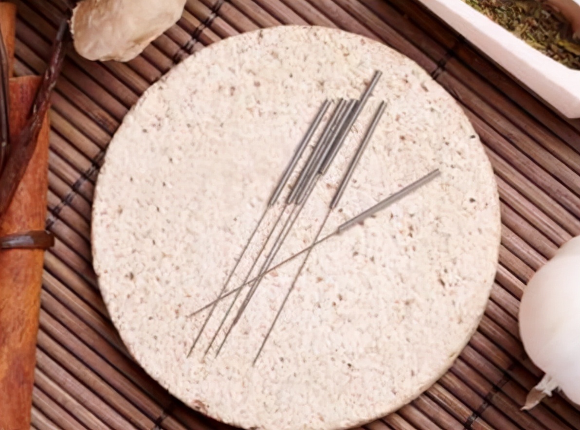 针灸可治疗促排卵吗,中医针灸可以促进排卵吗