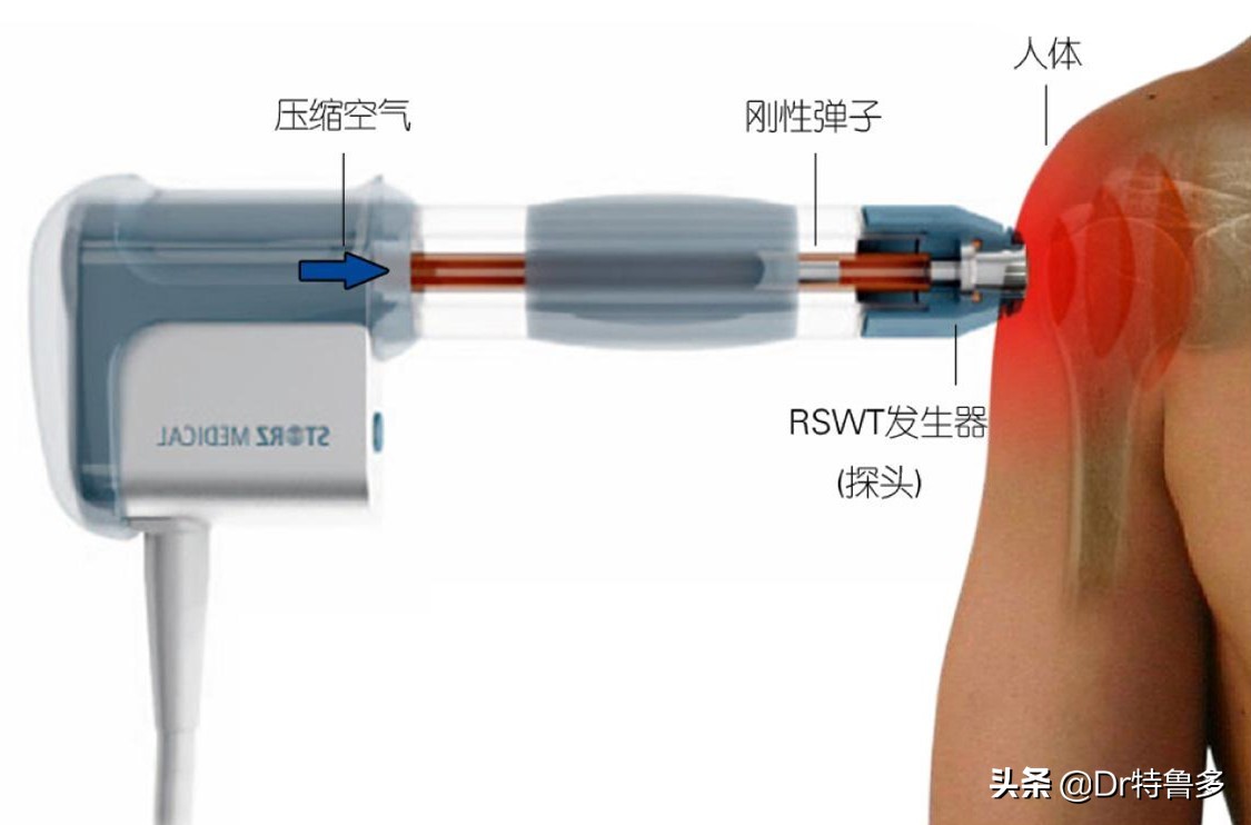 骨折了不长、长得慢怎么办?试试冲击波治疗吧