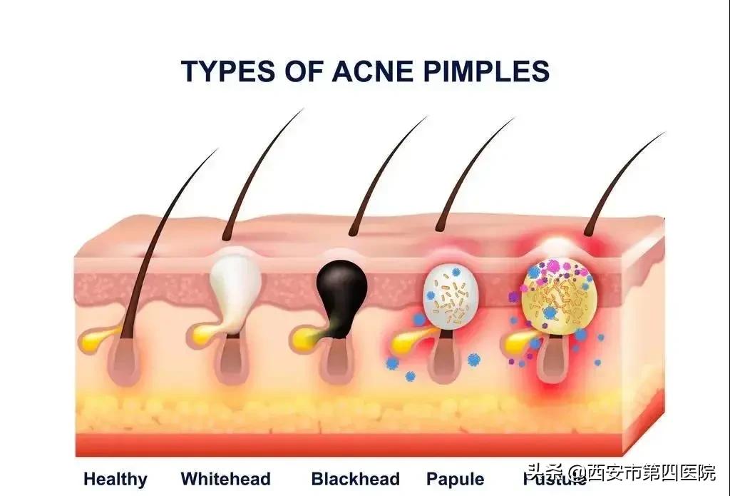 健康中国有哪些举措,健康中国行动攻略