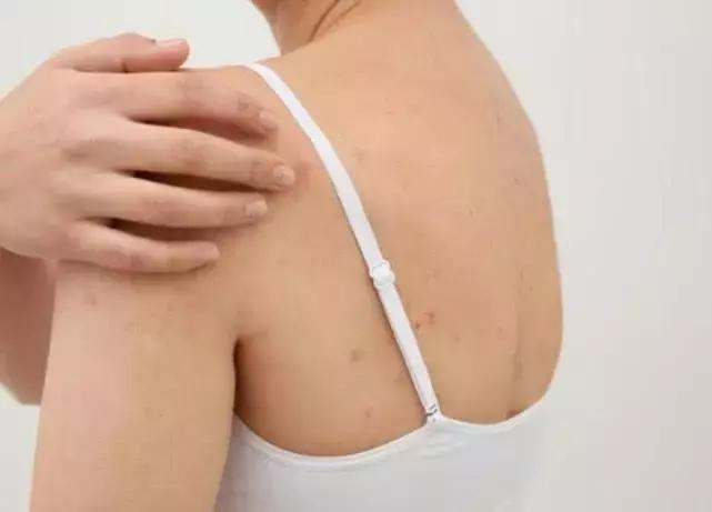 夏天就要心机露肤才更显瘦,又到了夏天露腿露肩的季节