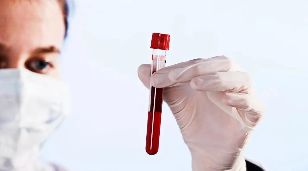 胆碱酯酶异常,胆碱酯酶异常怎么回事