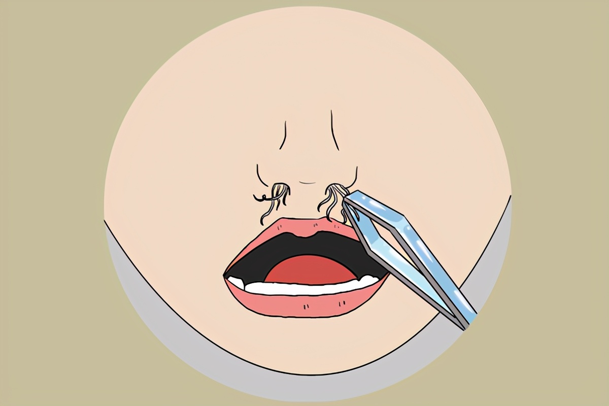 鼻毛突然变白是身体开始衰老了吗,鼻毛变白是衰老引起的吗