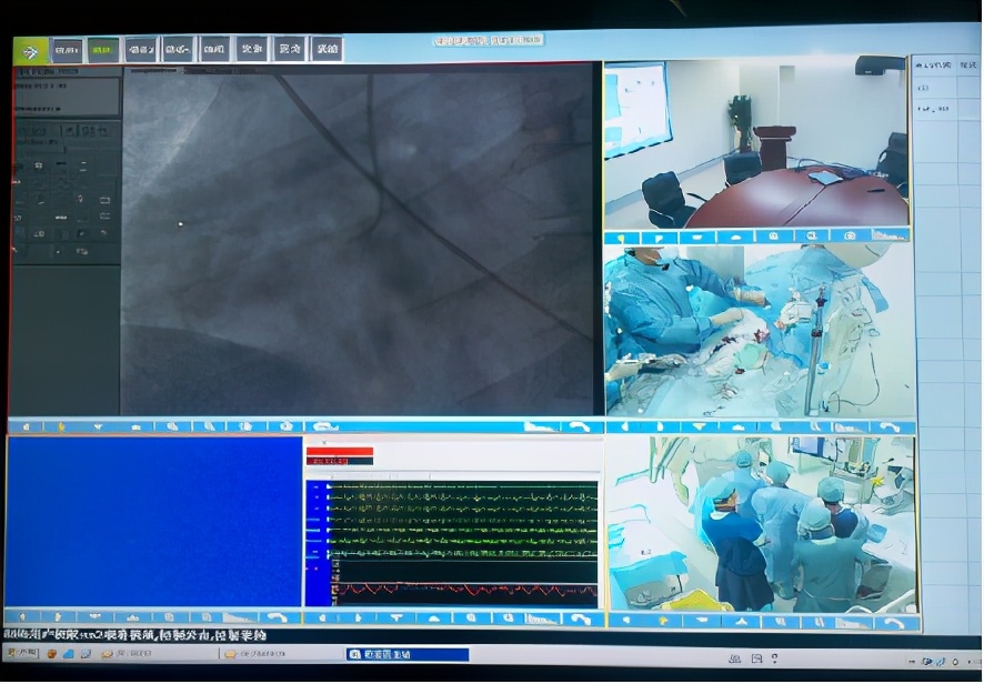 一体化手术室布局与管理,数字一体化手术室设备