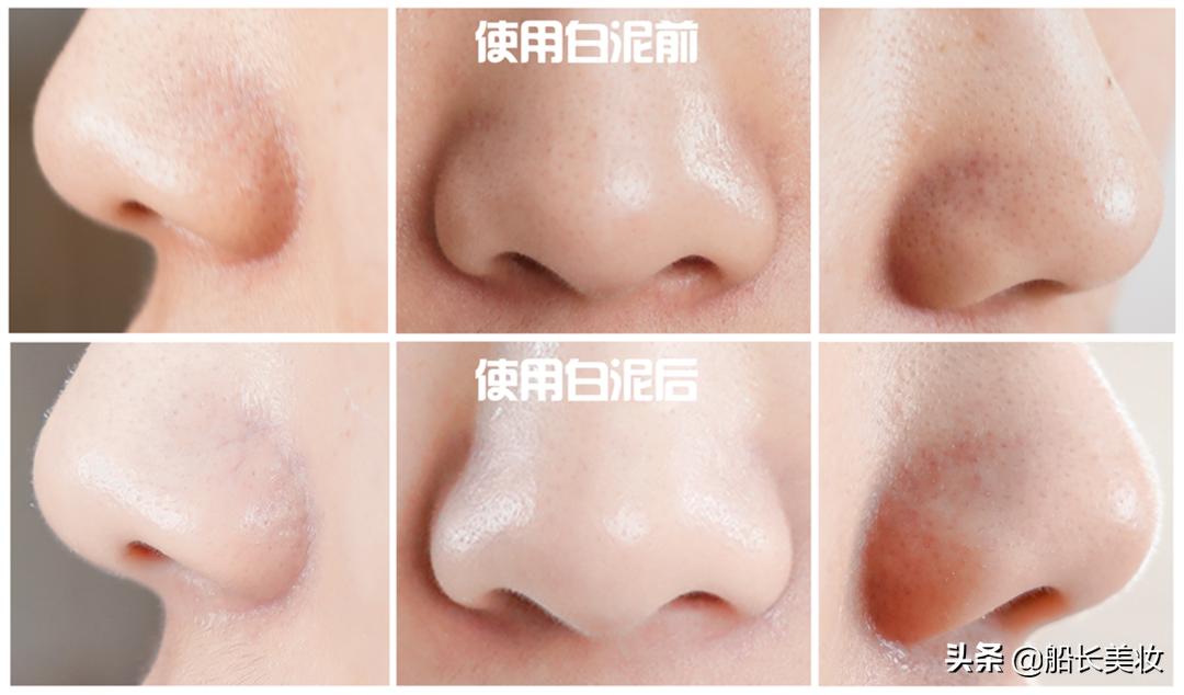 不用一次白泥,你永远不知道脸上有多脏