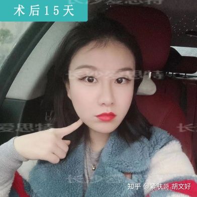 哪些人群不适合做热玛吉？