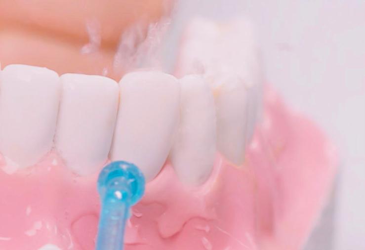 去口臭清洁口腔牙渍,口臭牙臭去除神器