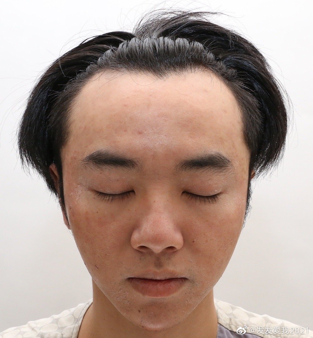 我证明：纯情少年华晨宇真的没有整容没有植发没有情人没有私生子