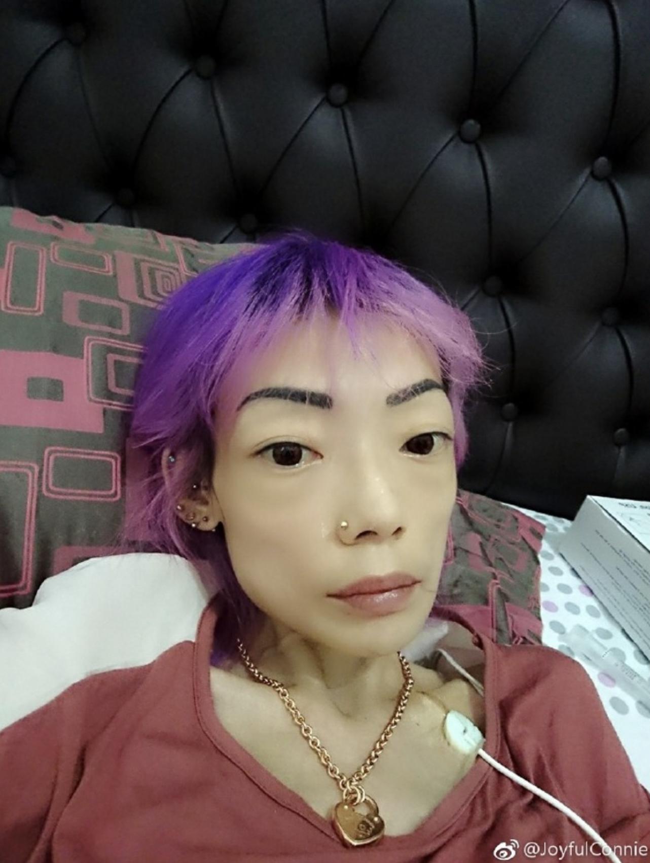 郭永淳前妻罕露脸精神尚可,仍暴瘦如柴,靠拍卖名牌赚钱筹医药费