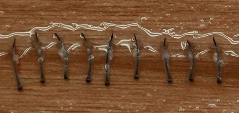 胸毛腿毛的毛囊能植发吗,胸毛可以用来植发嘛