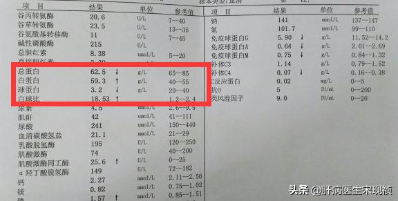 肝功白蛋白球蛋白偏高是什么意思,肝功能中的球蛋白偏高是什么意思