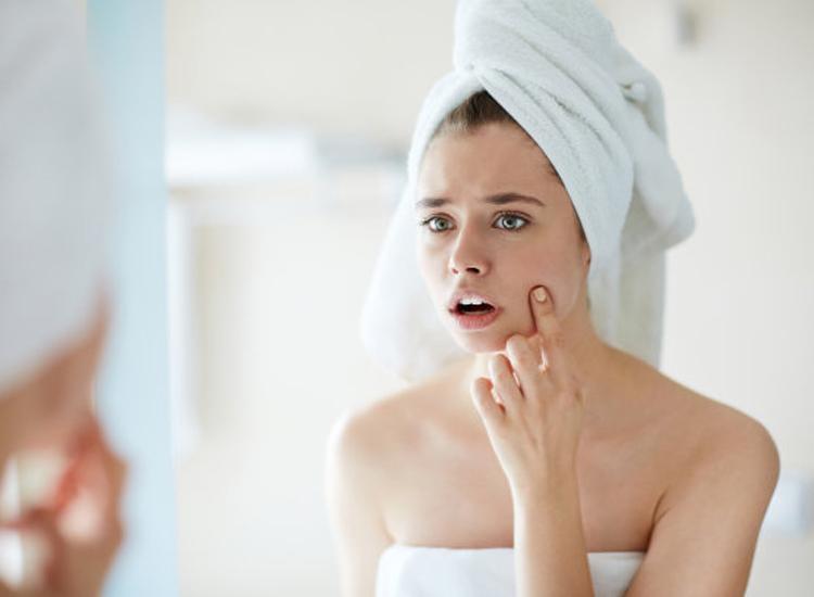 只要坚持这5个小习惯，轻松去鸡皮肤