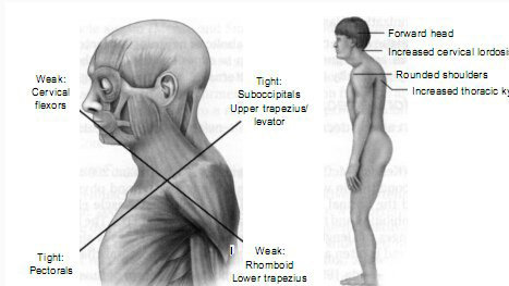 改善颈椎肩痛的锻炼器械,针对腰椎颈椎功能性锻炼