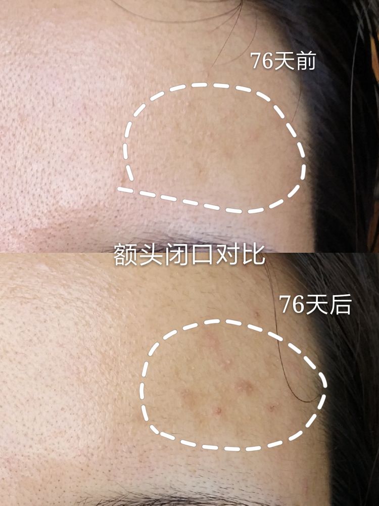 梵西六胜肽抗皱精华,薇娅梵西六胜肽精华液