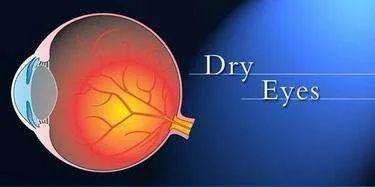 干眼症可以彻底治愈吗,干眼症能彻底治好吗
