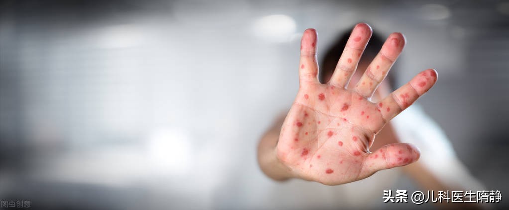 疱疹性咽峡炎的喉咙图片,流行咽疱疹